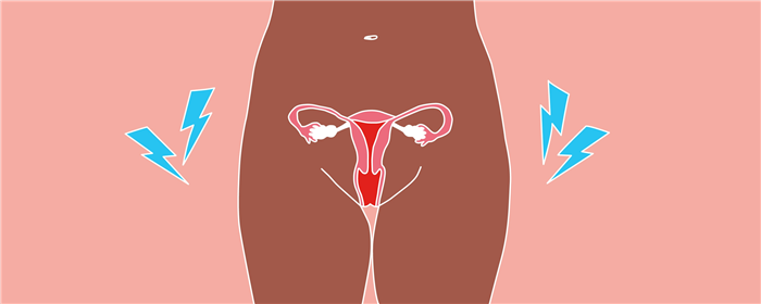 Как при эндометриозе делают ЭКО - За Рождение