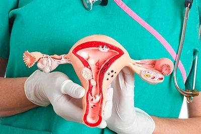 Эндометриоз: можно ли забеременеть