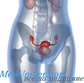 маточные кровотечения