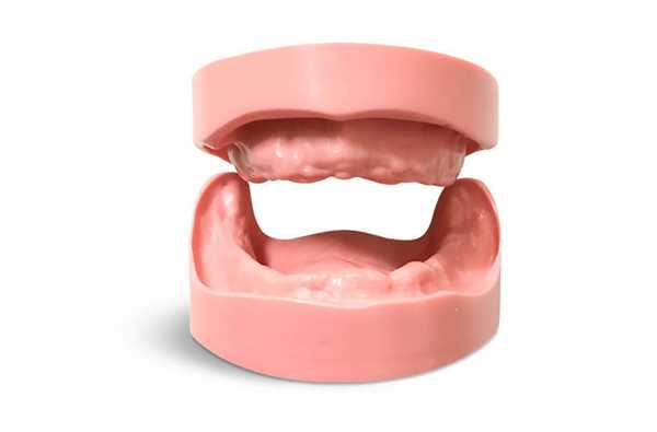 Первичная и вторичная адентия