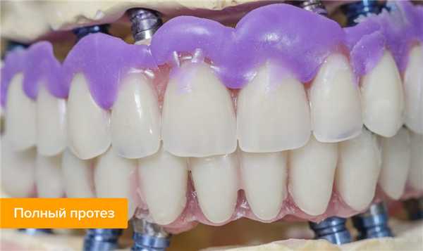 Фото полного протеза 