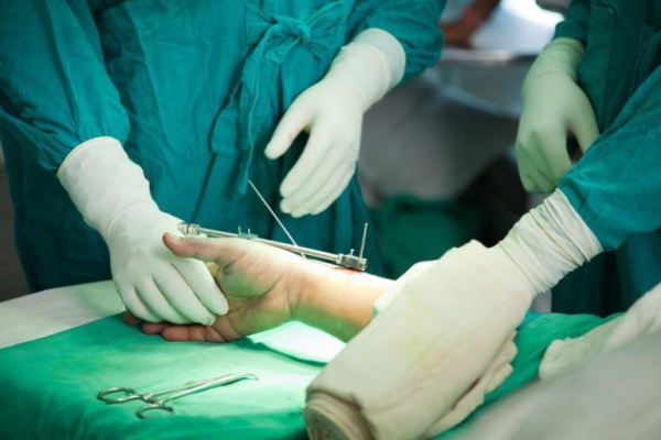 Хирургическая коррекция деформации пальцев рук