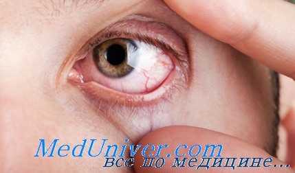 диабетическая катаракта