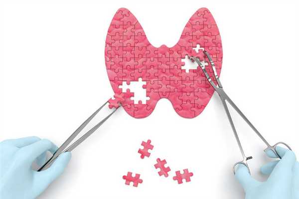 Дефицит йода