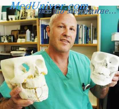 лечение ментального перелома