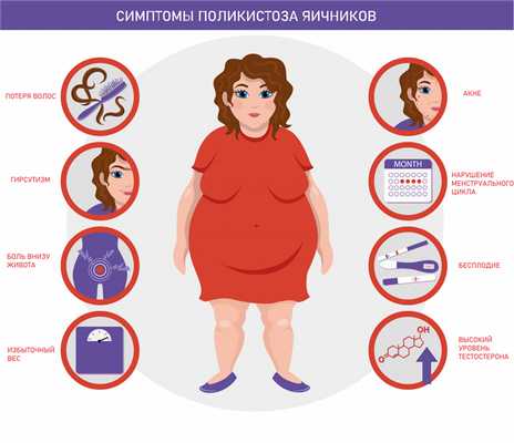 Поликистоз яичников.jpg
