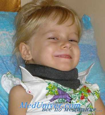 Интрамедуллярные опухоли спинного мозга. Диагностика, лечение опухолей спинного мозга.