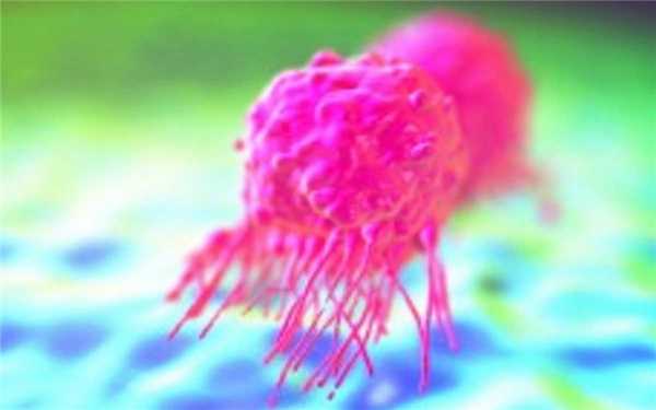 Инвазивный рак молочной железы