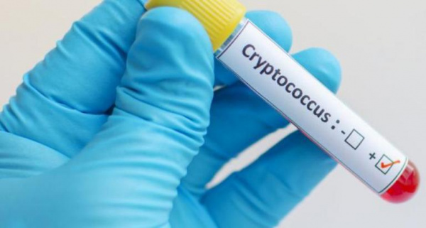 Нейросифилис