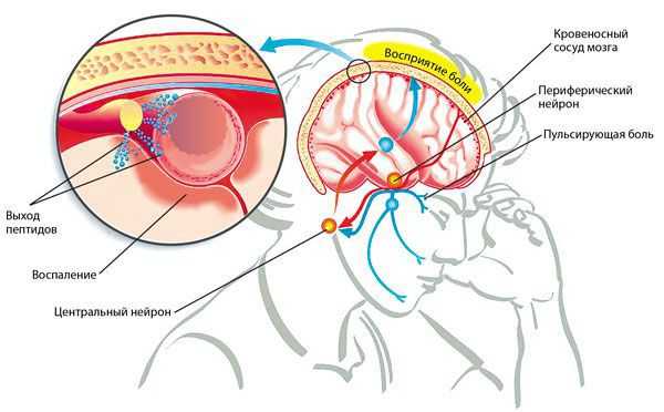 Связь пептидов и мигрени