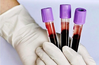 Анализ крови