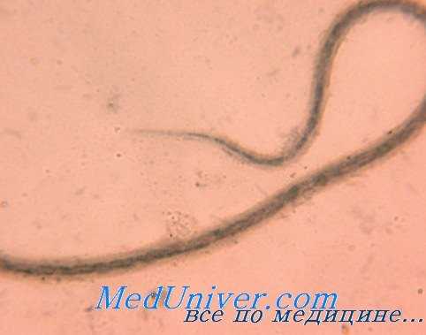 лечение онхоцеркоза
