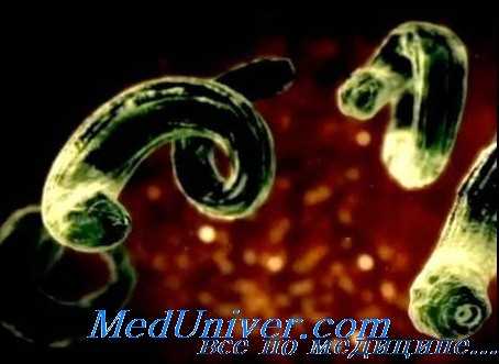 онхоцеркоз глаз