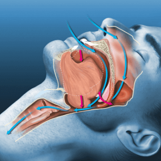 Синдром обструктивного апноэ сна (СОАС)