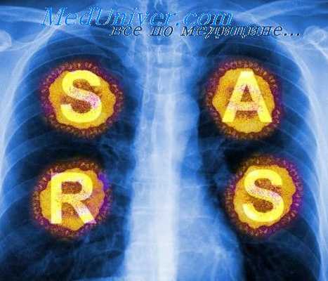 острый респираторный синдром