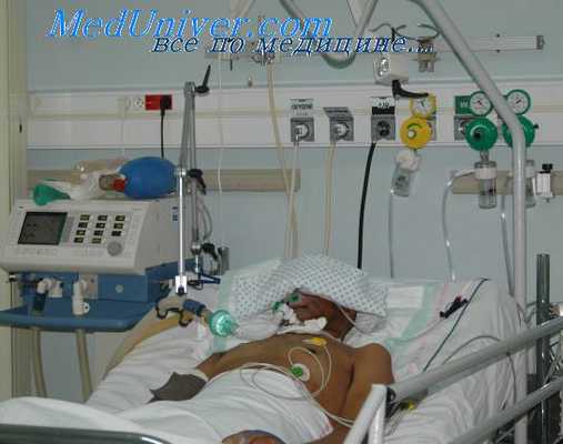 интенсивная терапия в неврологии