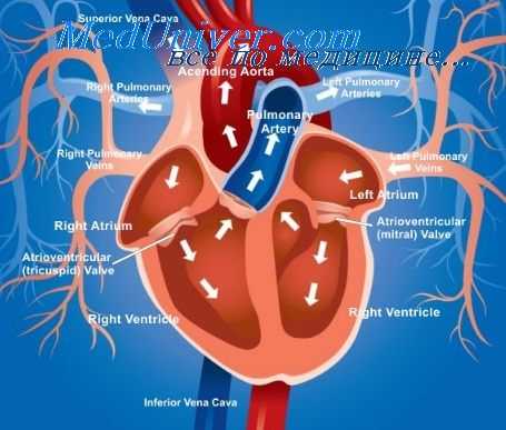 левожелудочковая недостаточность