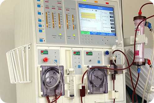 аппарат гемодиализа