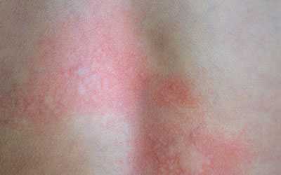 Крапивница - Салерно