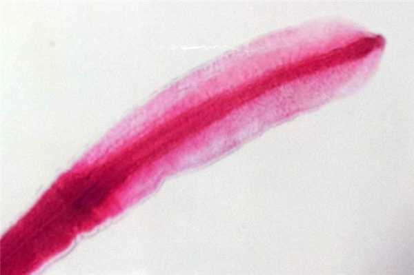 Причины и особенности развития глистных инвазий