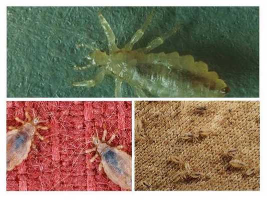 Платяные вши фото