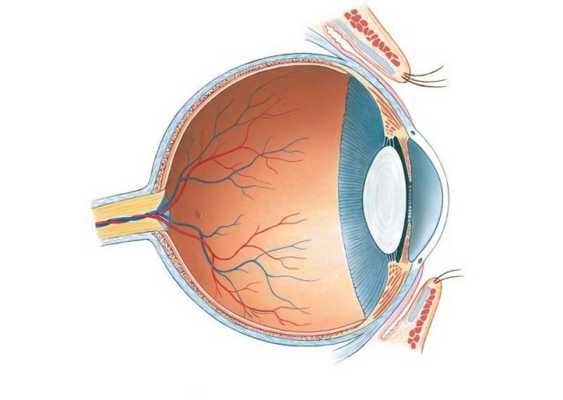 Синдром первичного персистирующего гиперпластического стекловидного тела