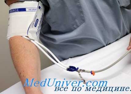 функциональная венозная гипертония