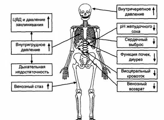 Абдоминальный компартмент-синдром. А существует ли абдоминальный компартмент-синдром?