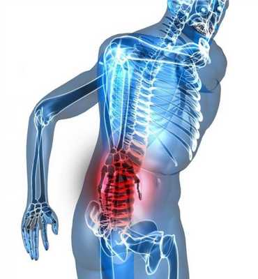 Симптомы люмбаго