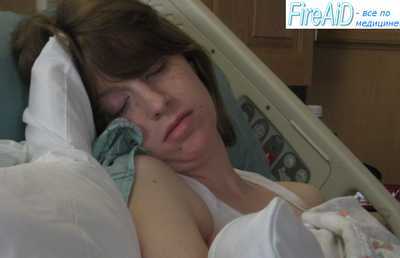 Лечение эклампсии. Купирование приступов эклампсии.