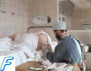 Лечение эклампсии. Купирование приступов эклампсии.