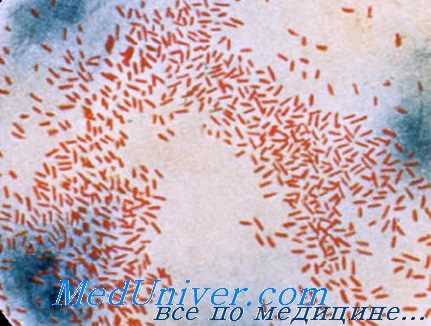 инфекция haemophilus