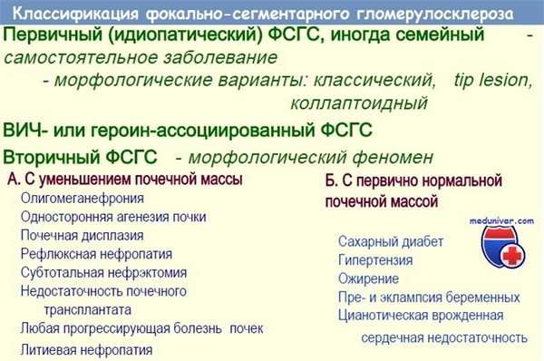 Фокально-сегментарный гломерулосклероз