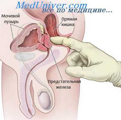 лечение проктальгии