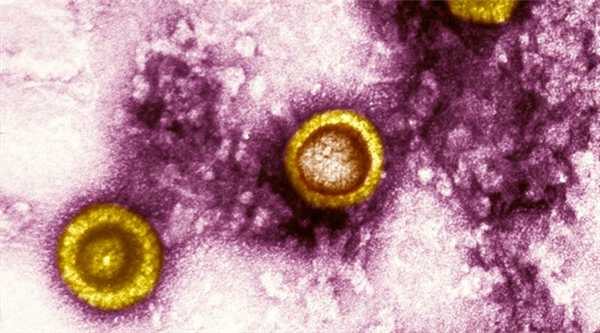 вирус герпеса