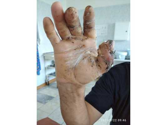 Результат лечения