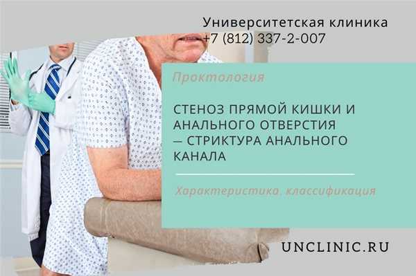 You are currently viewing Стеноз прямой кишки и анального отверстия — стриктура анального канала