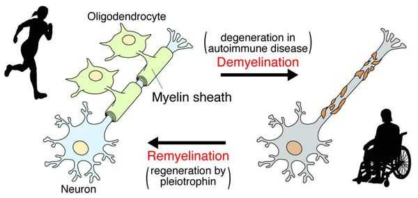 Ремиелинизация нервных волокон