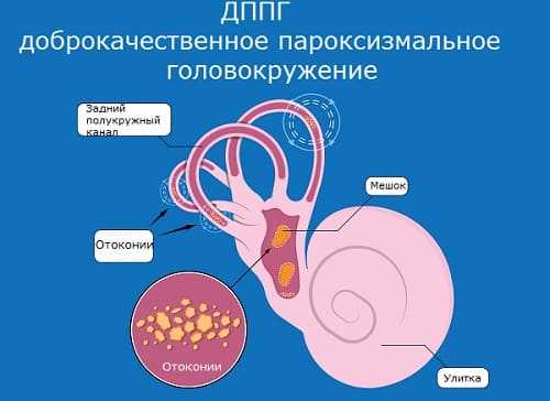 Отолиты и орган равновесия