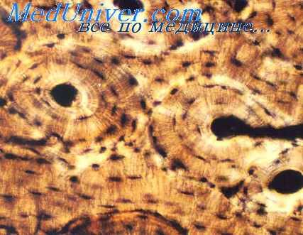 радиоактивные вещества в организме