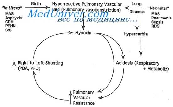 легочная гипертензия