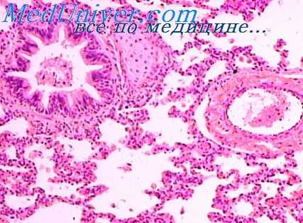 артериолы легких