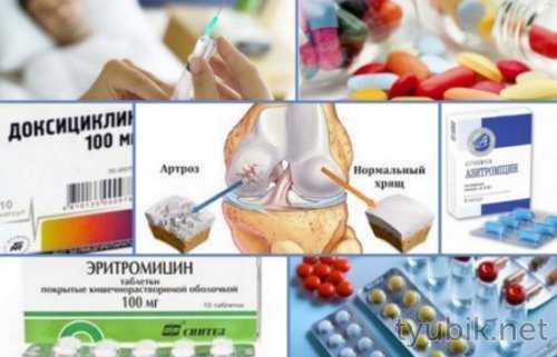 Средства при воспалении суставов