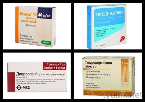 Препараты при суставной боли