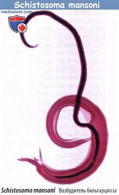 Шистосомоз Schistosoma manson - бильгарциоз
