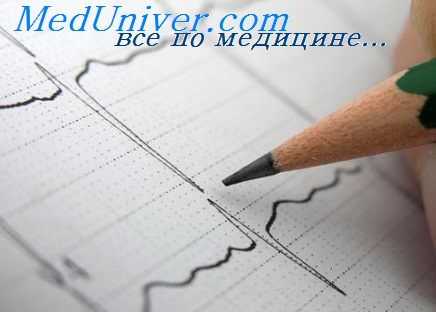 антиаритмические препараты