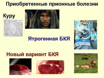 Прионные болезни