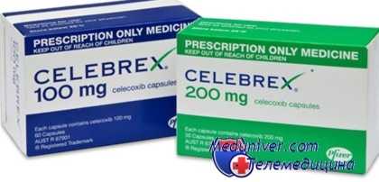 противовоспалительные препараты