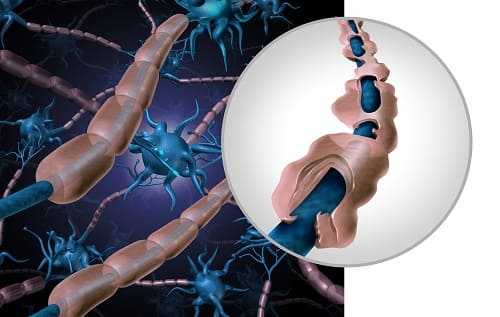 Дегенеративные поражения мозга