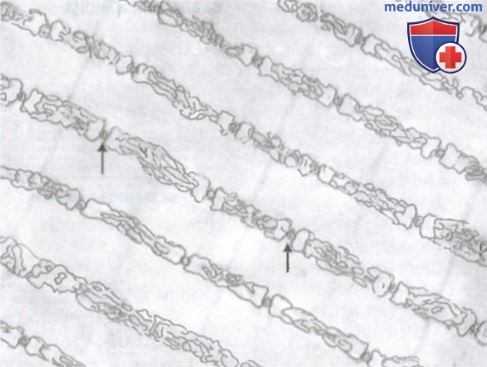 строение мышечного волокна